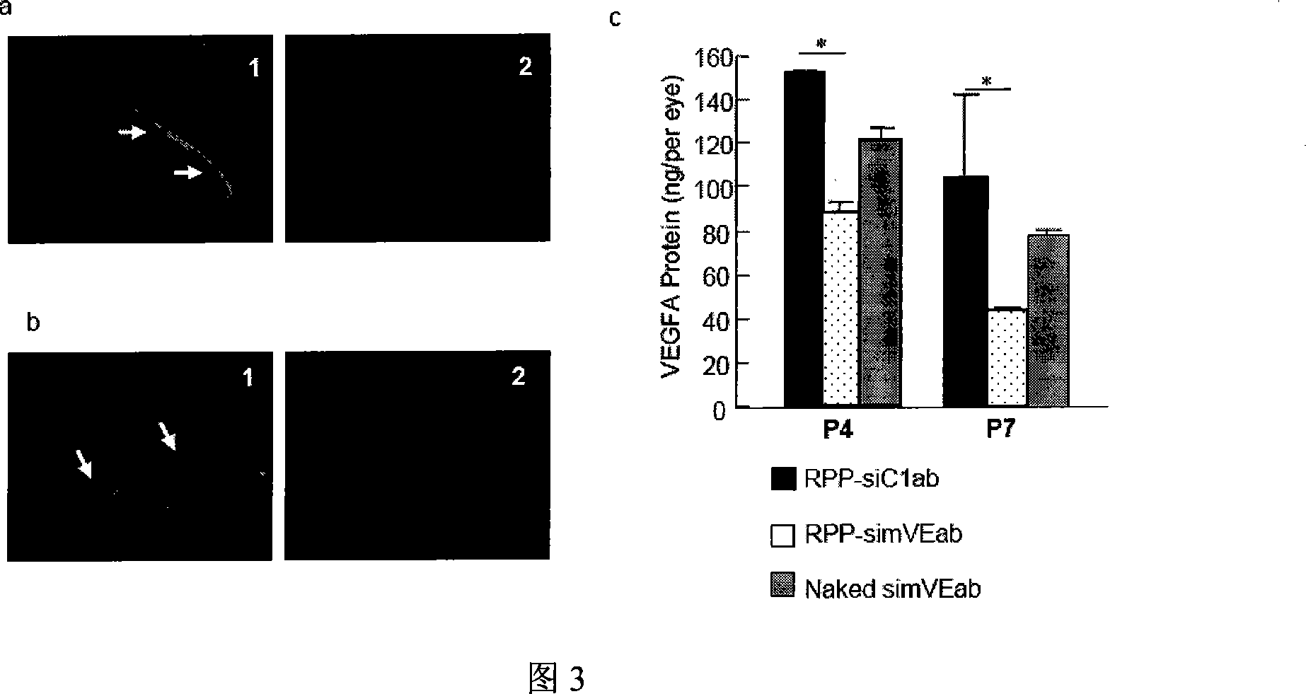 Multiple target point small interference RNA cocktail agent for treating ophthalmic disease and preparing  method thereof