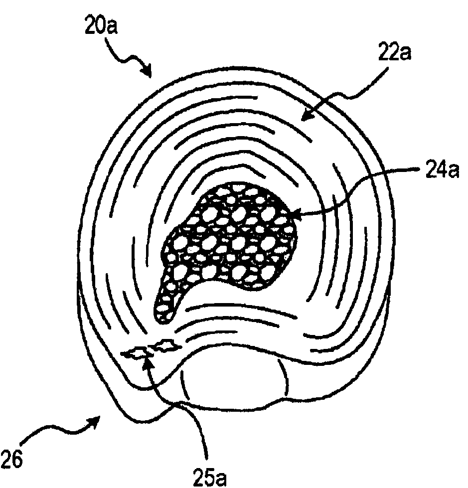 Alpha adrenergic receptor agonists for treatment of degenerative disc disease