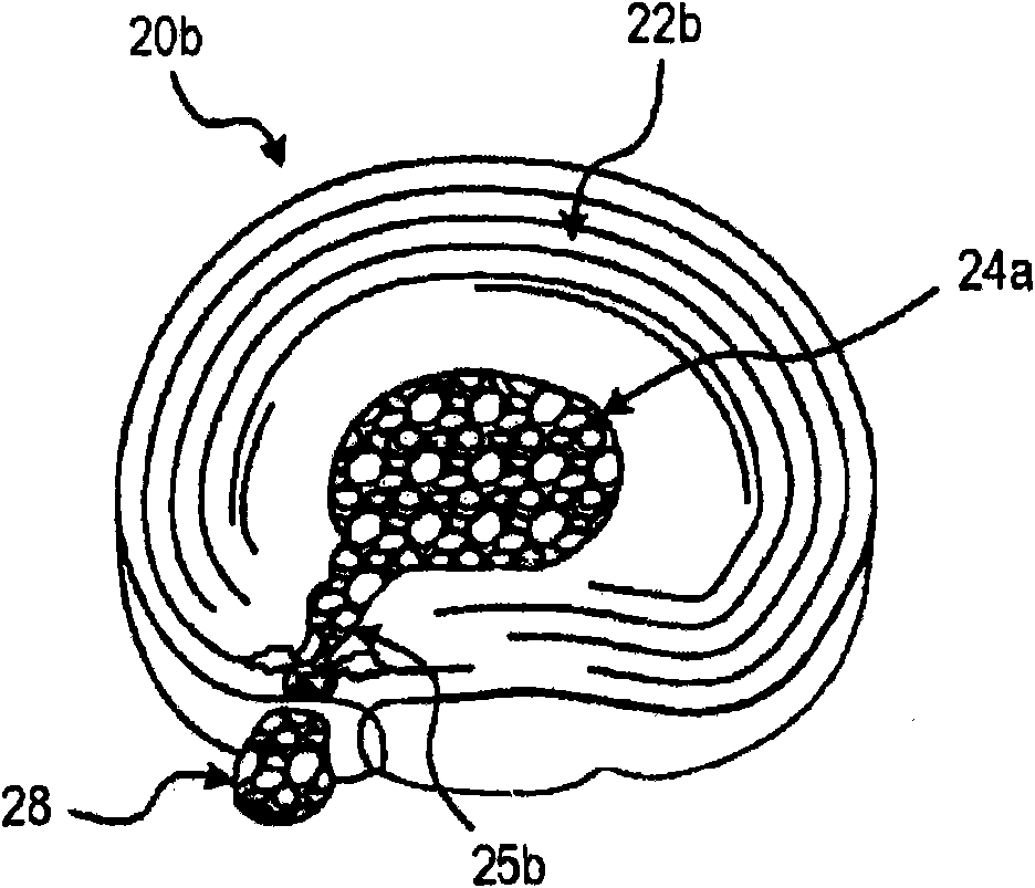 Alpha adrenergic receptor agonists for treatment of degenerative disc disease