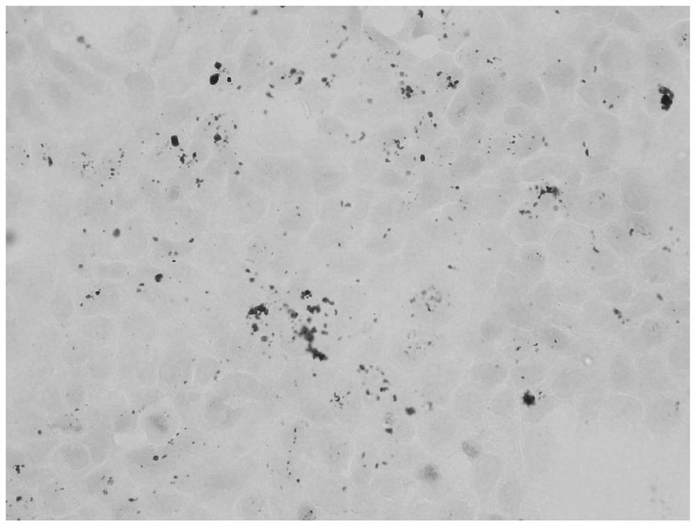 A preparation method of iron oxide nanoparticles and its application in tumor targeted diagnosis and treatment