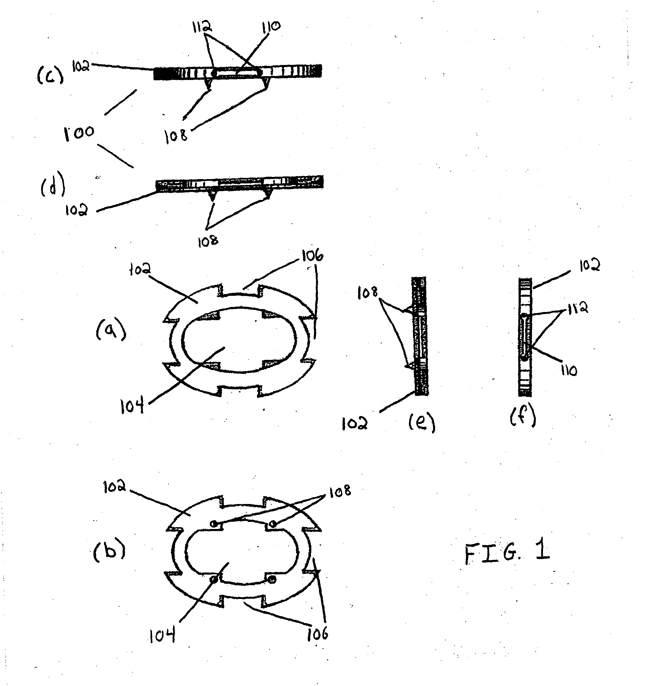 Spinal disc prosthesis system