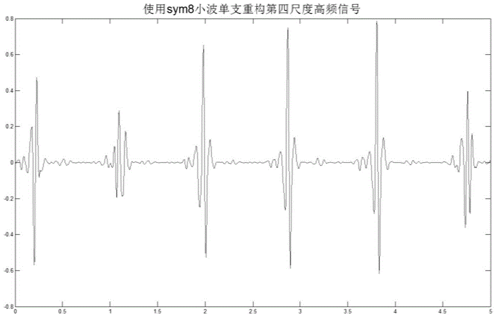 Multistage lead electrocardiograph signal QRS waveform identification method