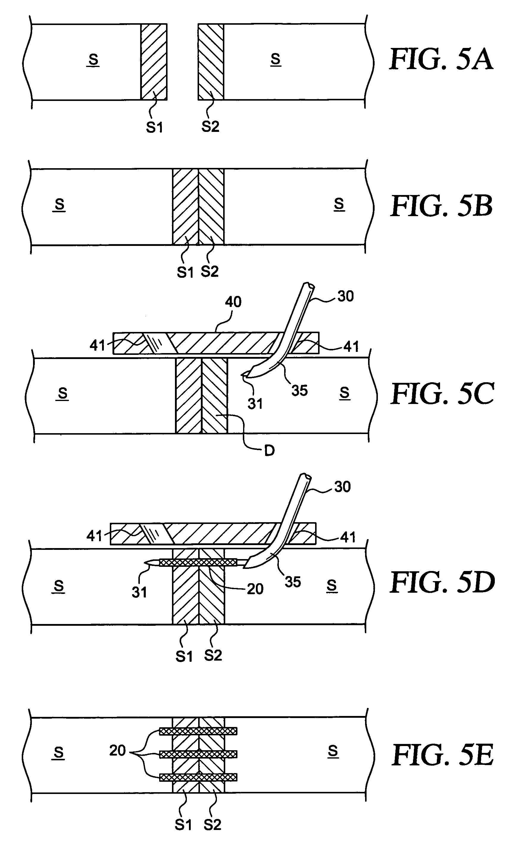 Methods and apparatus for treating an injured nerve pathway