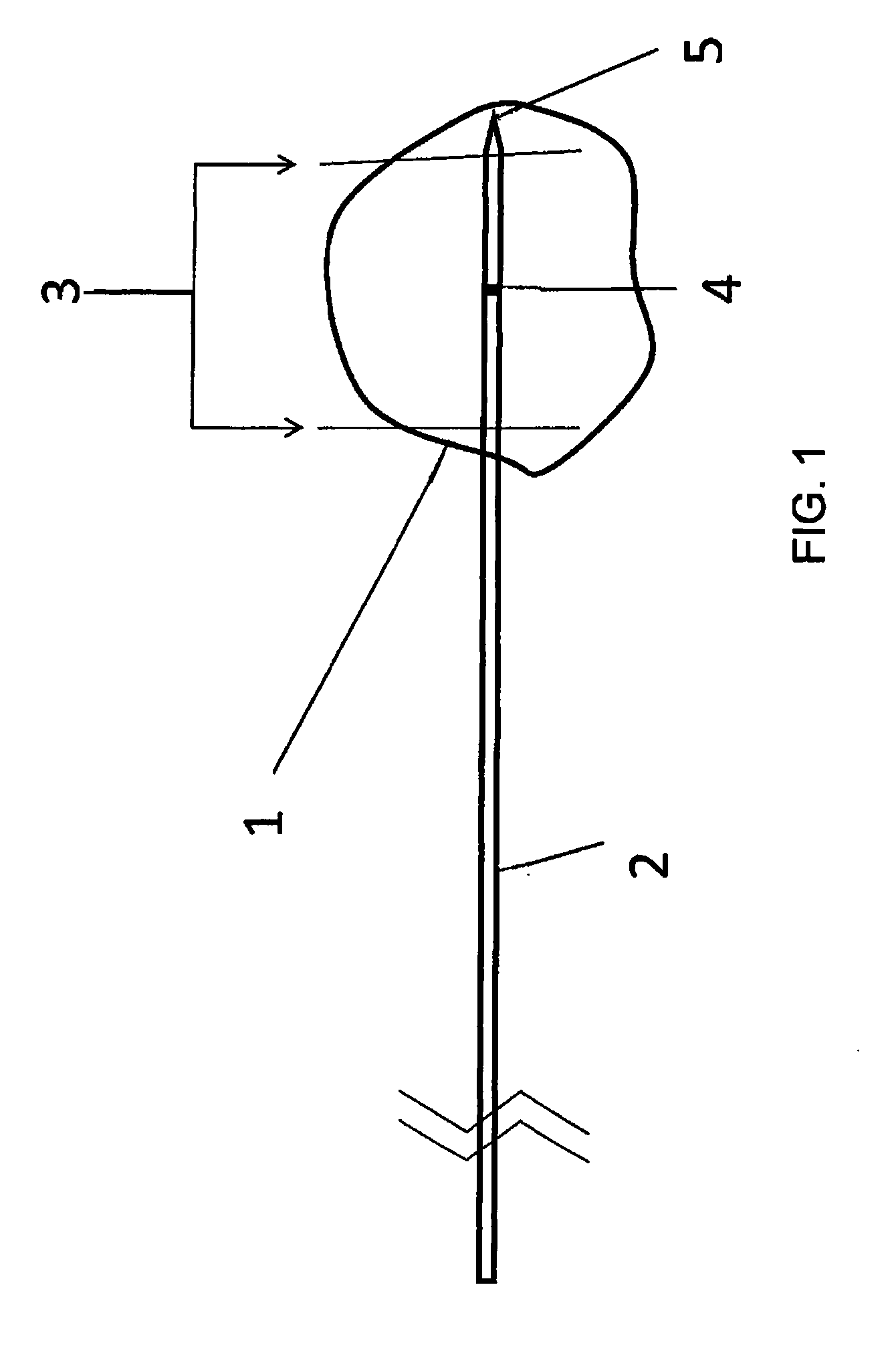 Device and Method for Three-Dimensional Guidance and Three-Dimensional Monitoring of Cryoablation