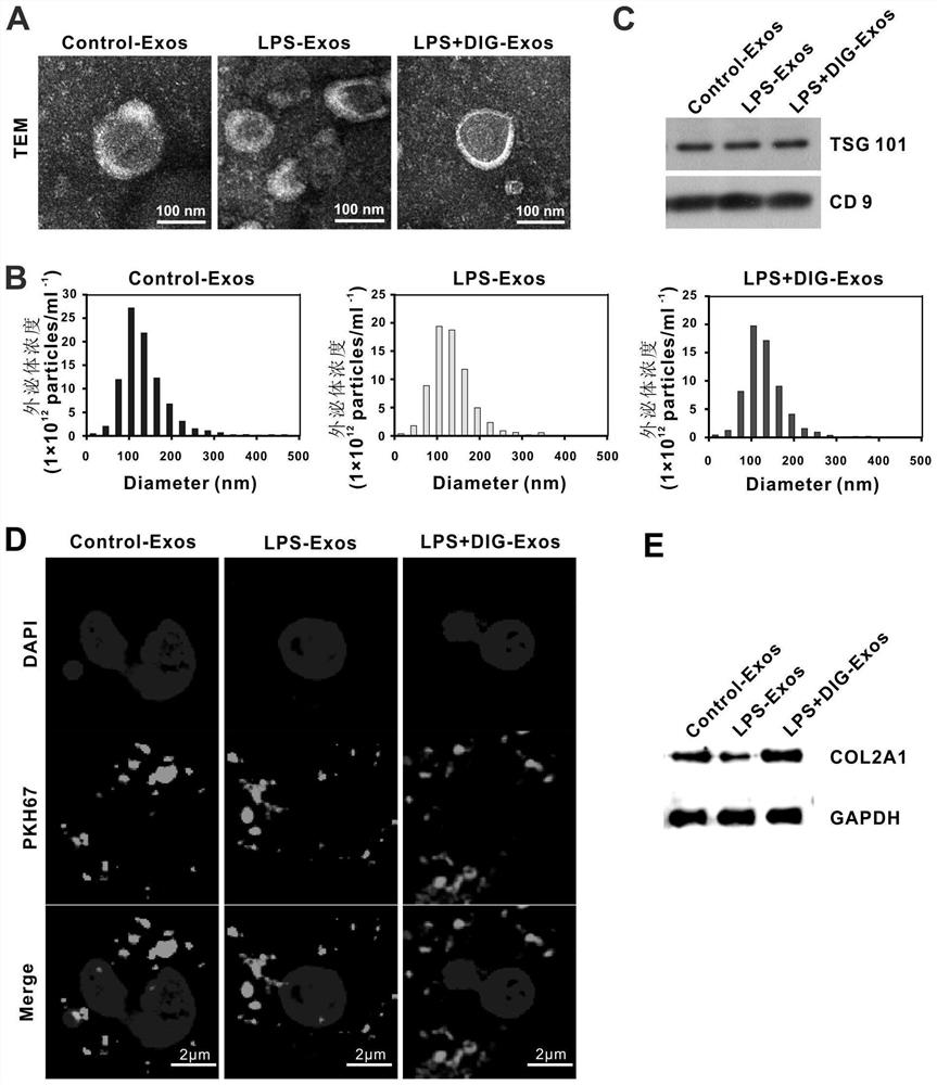 Application of digoxin in preparation of medicine for treating and/or preventing macrophage M1 type polarization related diseases
