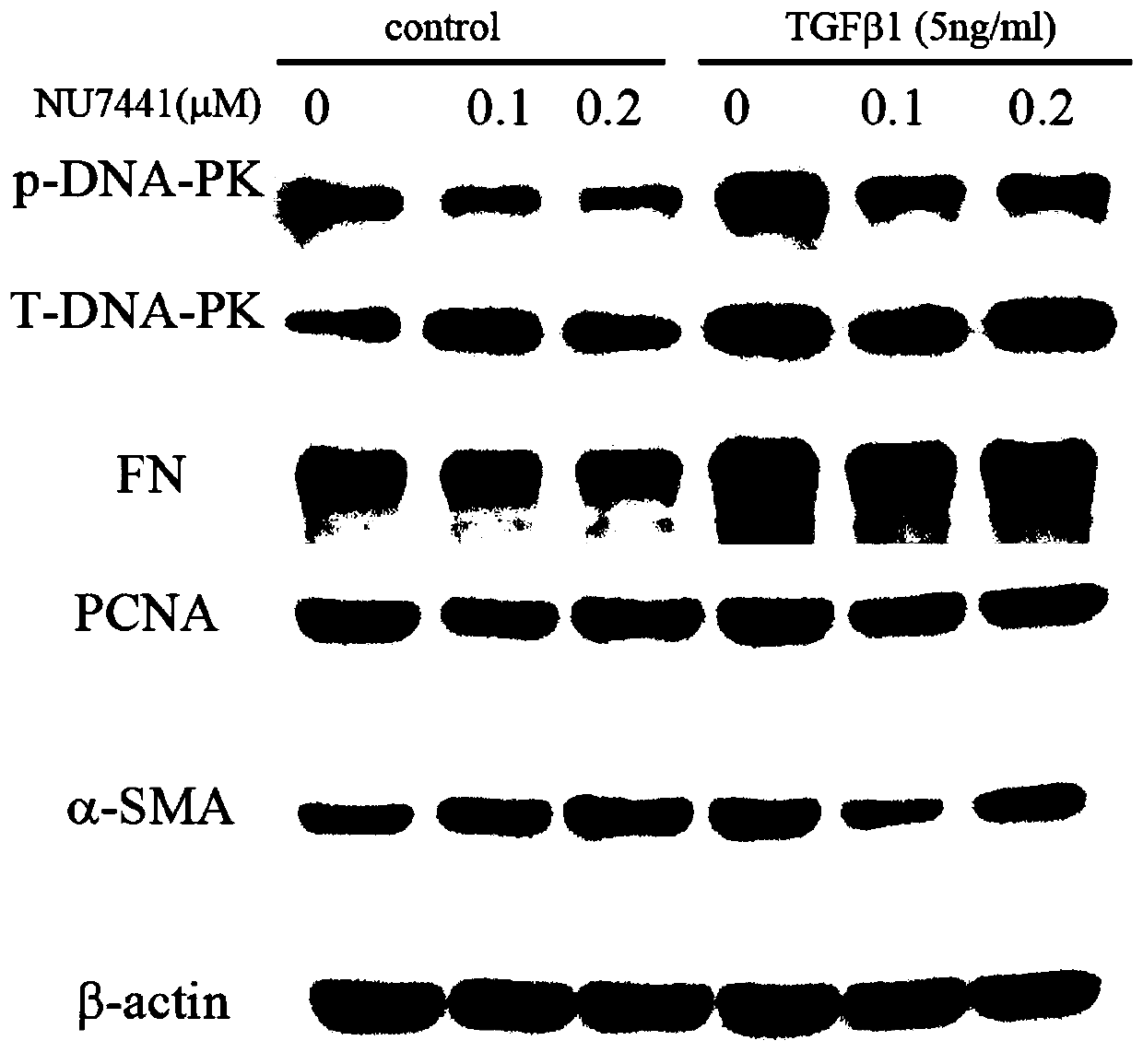 Use of DNA-dependent protein kinase specific inhibitor in preparation of drugs to prevent and treat renal fibrosis