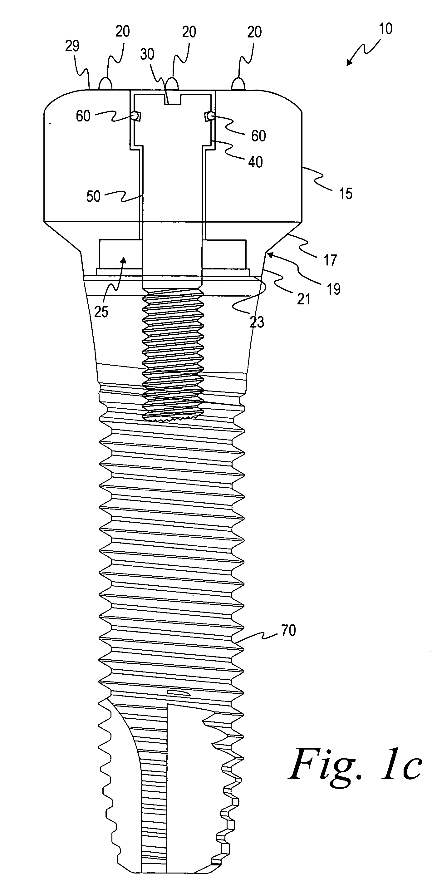 Methods for manufacturing dental implant components