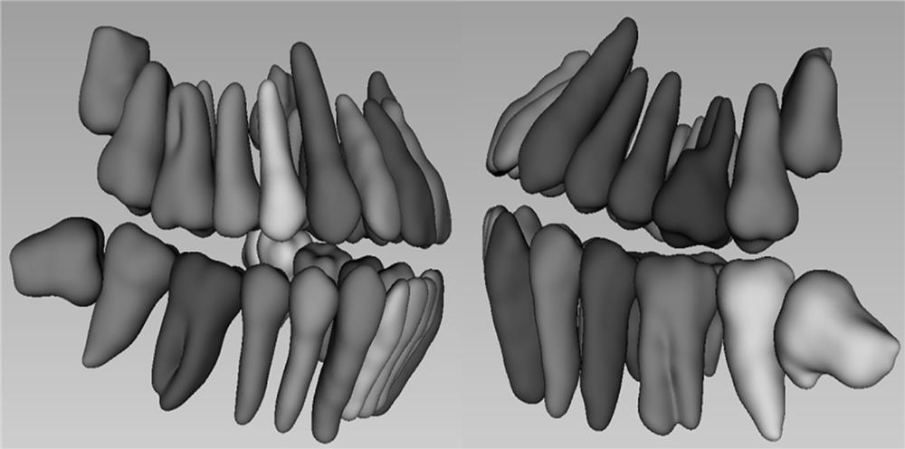 Tooth segmentation and reconstruction method based on CBCT image and storage medium