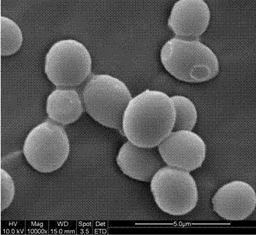 Rhodotorula mucilaginosa capable of degrading urethane and its application in liquor products and food