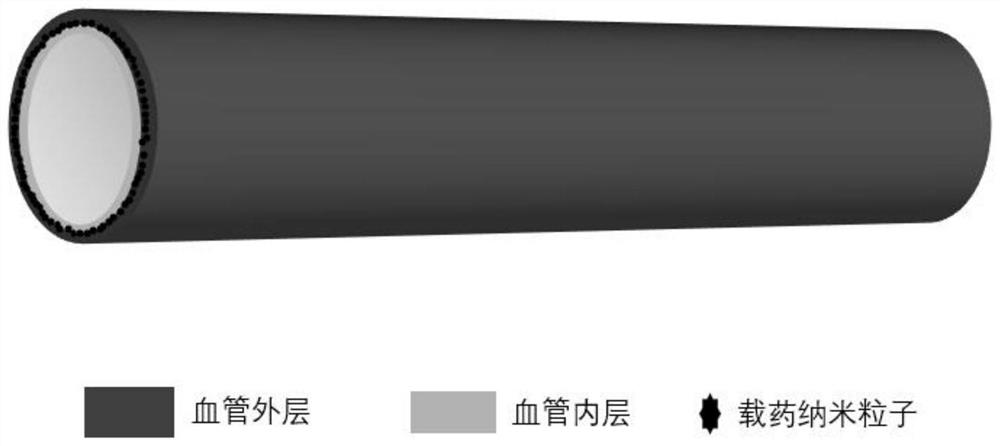 Artificial blood vessel with double functions of endothelialization promotion and anticoagulation as well as preparation method and application of artificial blood vessel