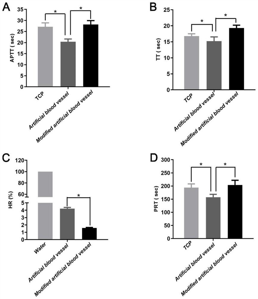 Artificial blood vessel with double functions of endothelialization promotion and anticoagulation as well as preparation method and application of artificial blood vessel