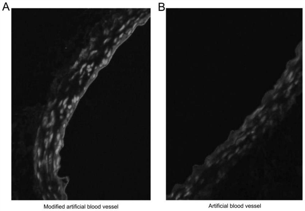 Artificial blood vessel with double functions of endothelialization promotion and anticoagulation as well as preparation method and application of artificial blood vessel