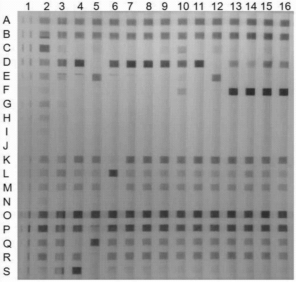 Specific fragment composition of mycobacterium tuberculosis drug-resistant gene of four second-line drugs and application thereof