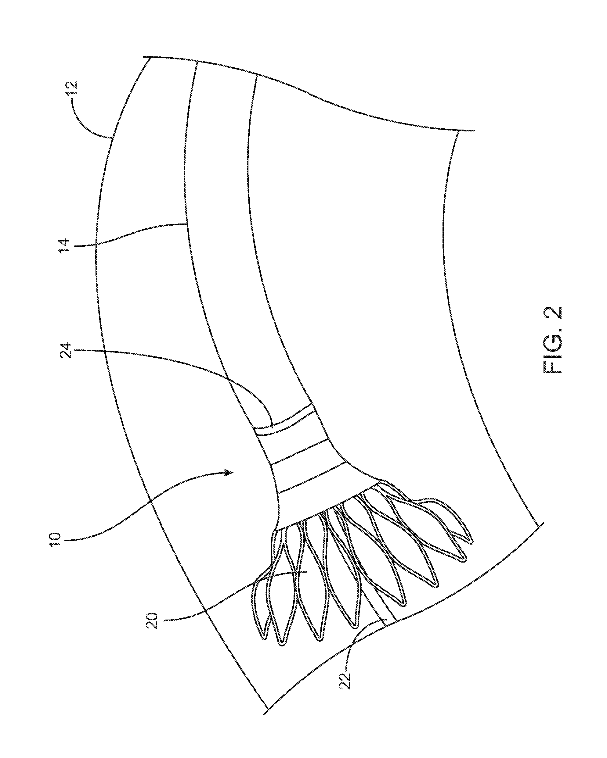 Medical Device Delivery Systems and Methods of Use Thereof
