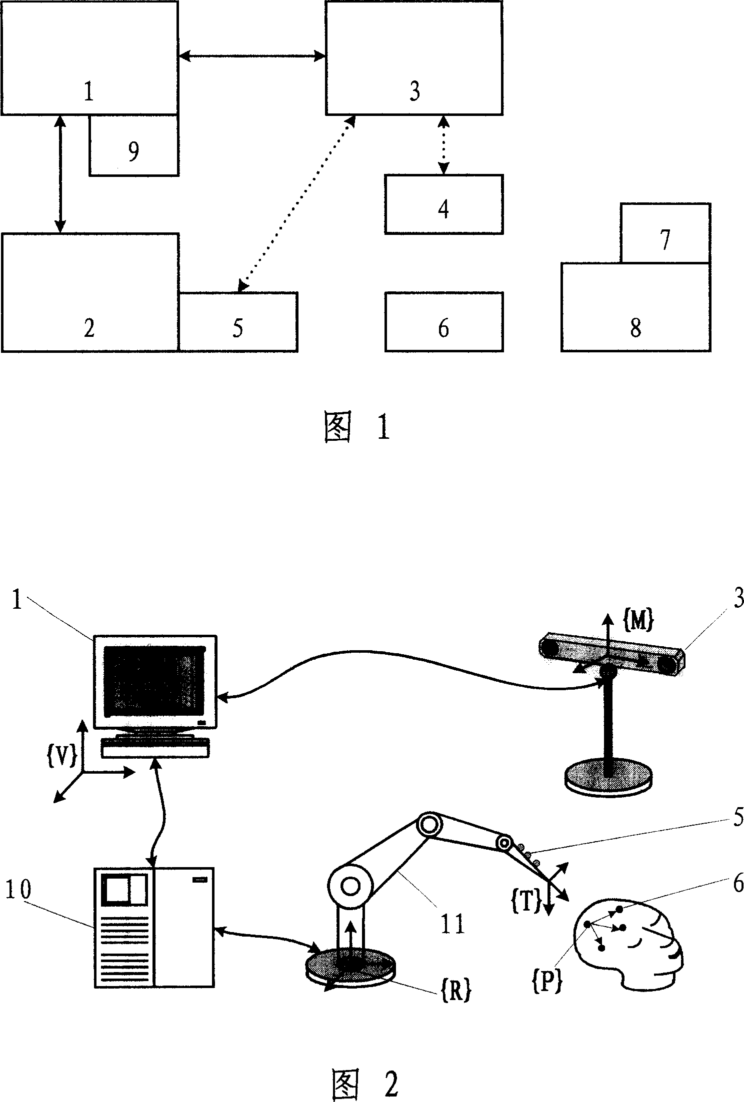 Celebral operating robot system based on optical tracking and closed-loop control and its realizing method