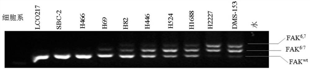 Focal adhesion kinase splice isoforms and their applications