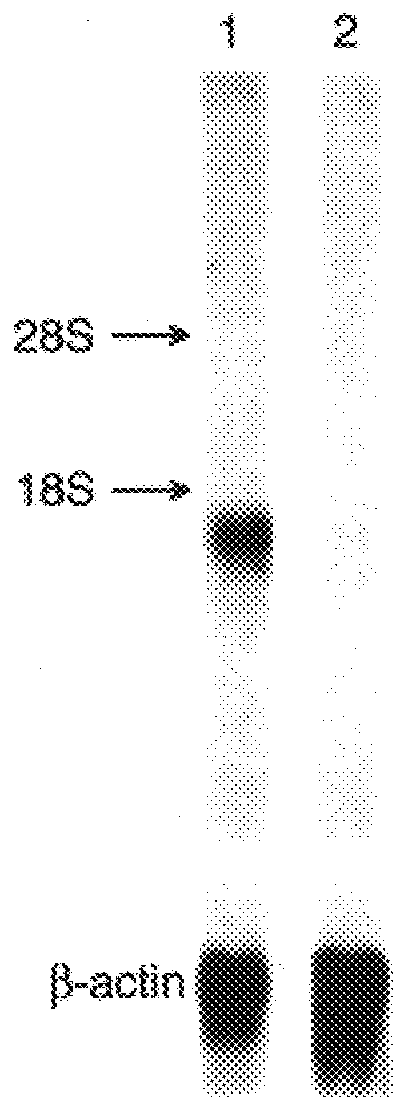 Doc tumor suppressor protein and gene