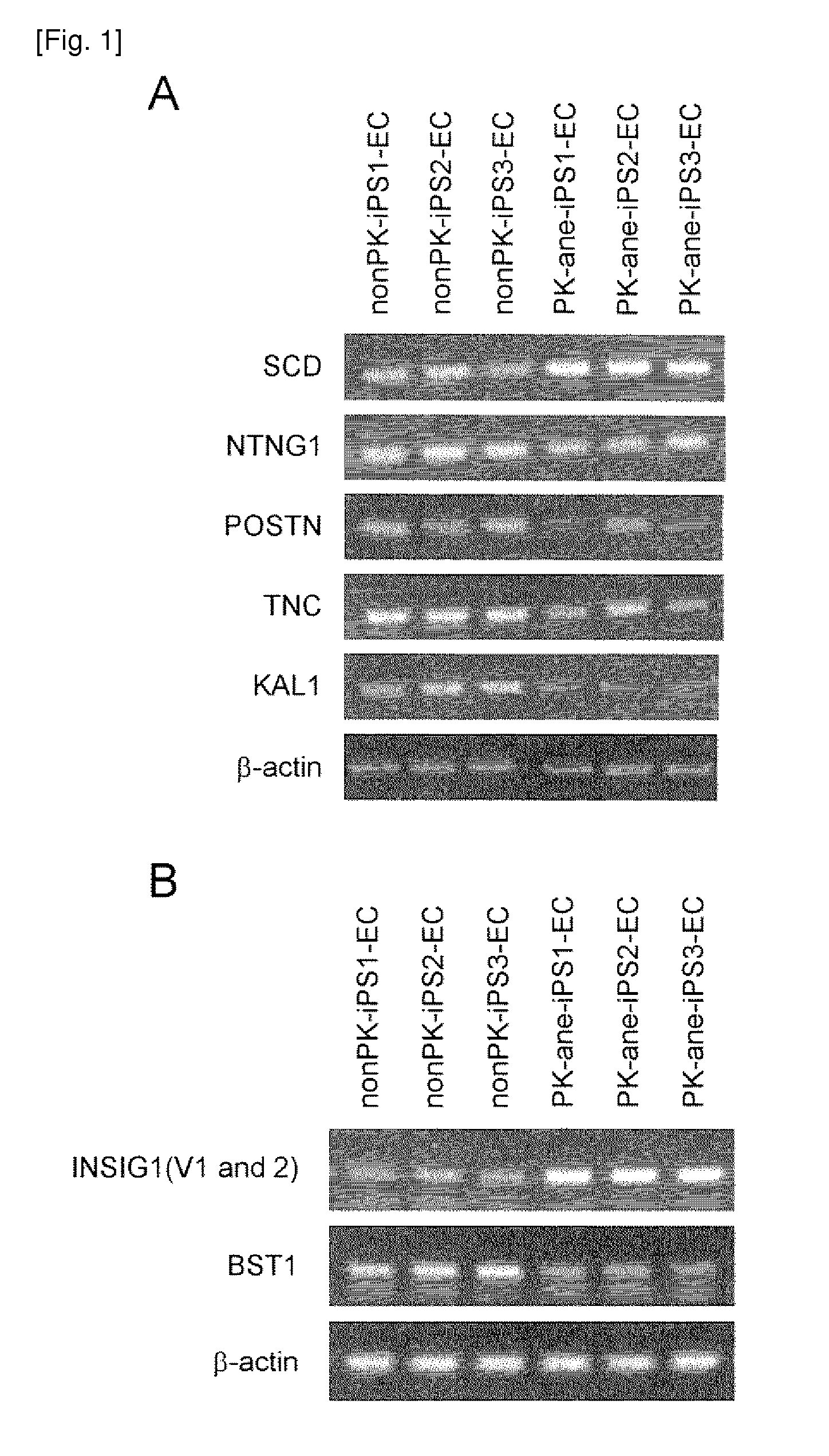 Method of examining polycystic kidney disease and method of screening for therapeutic agent of the disease