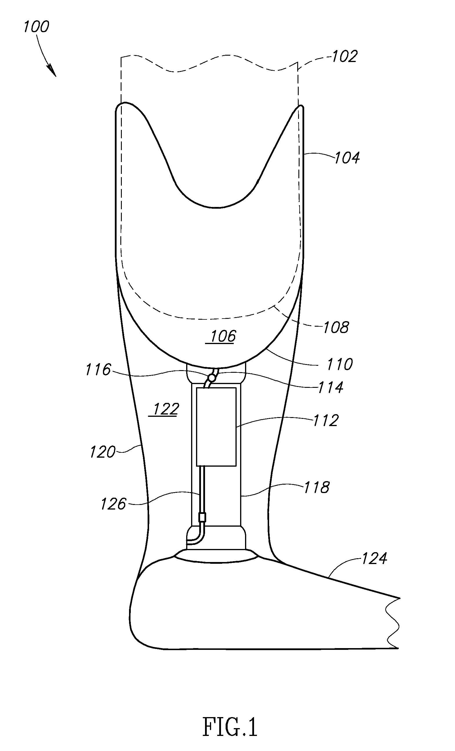 Control system for prosthesis