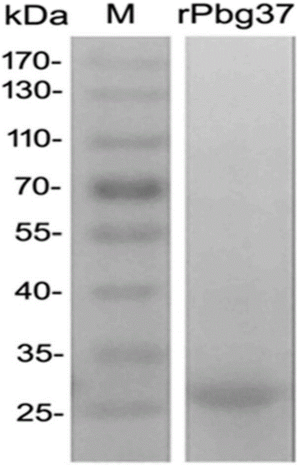 Plasmodium berghei gametophyte recombinant protein (rPbG37), preparation method thereof and application of Plasmodium berghei gametophyte recombinant protein (rPbG37) in malaria transmission blocking