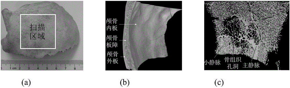 Parametric design method of defective skull tissue engineering vascular stent on the basis of microscope CT (Computed Tomography) measurement