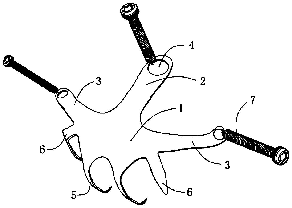 Patella inferior pole fracture internal fixing device and screw fixing method