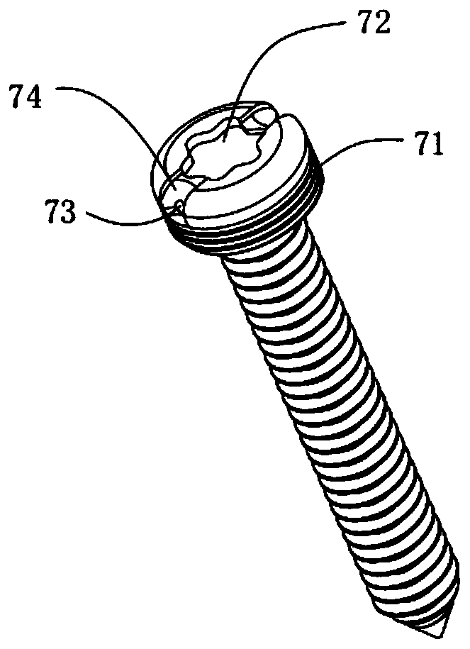 Patella inferior pole fracture internal fixing device and screw fixing method