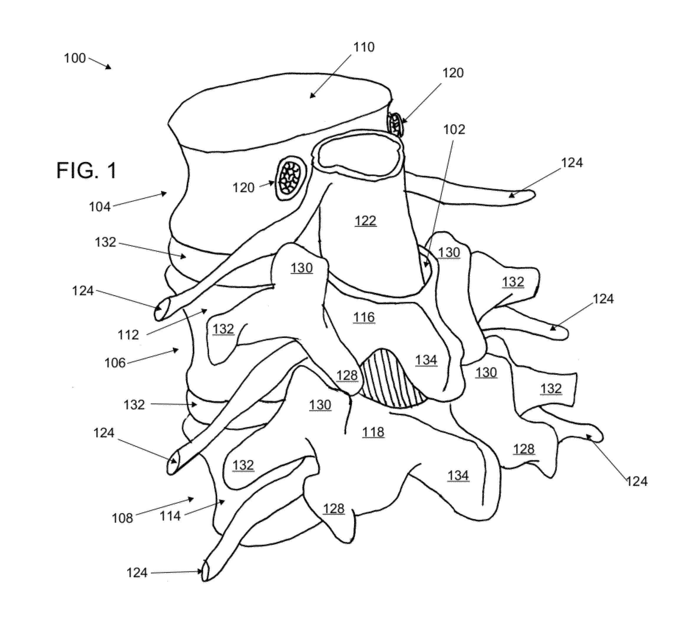 Cannulotome