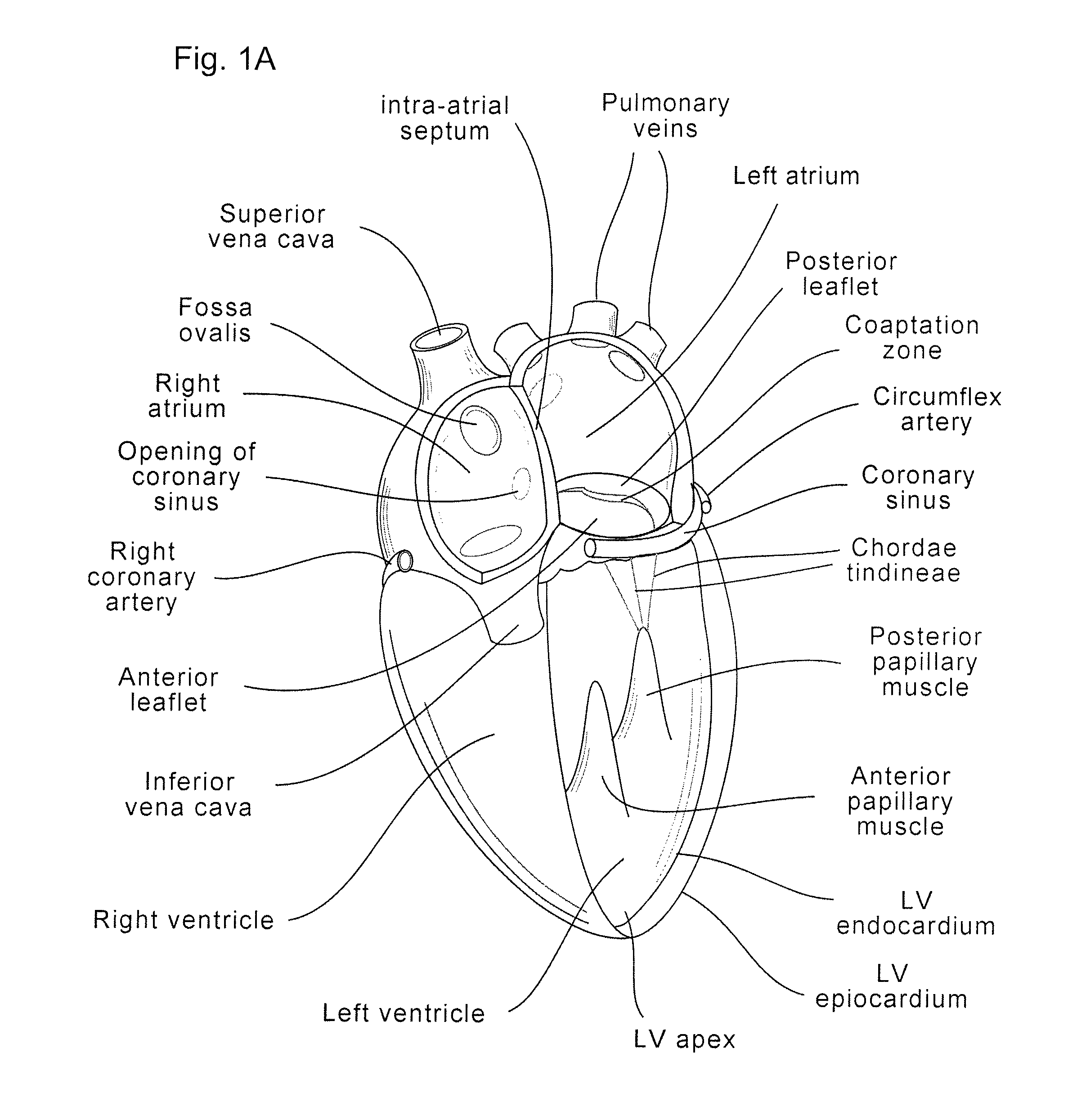 Coaptation enhancement implant, system, and method