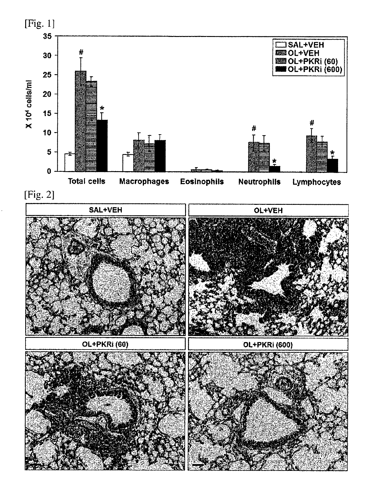Composition for prevention or treatment of bronchial asthma comprising PKR inhibitor as active ingredient