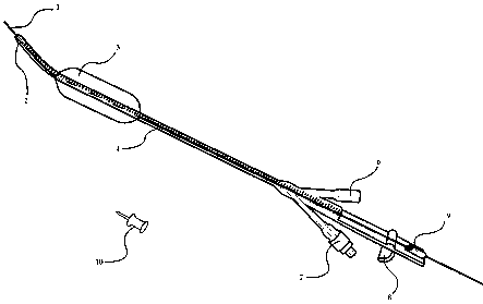 Novel urethral stenosis expanding and catheter indwelling assisting device