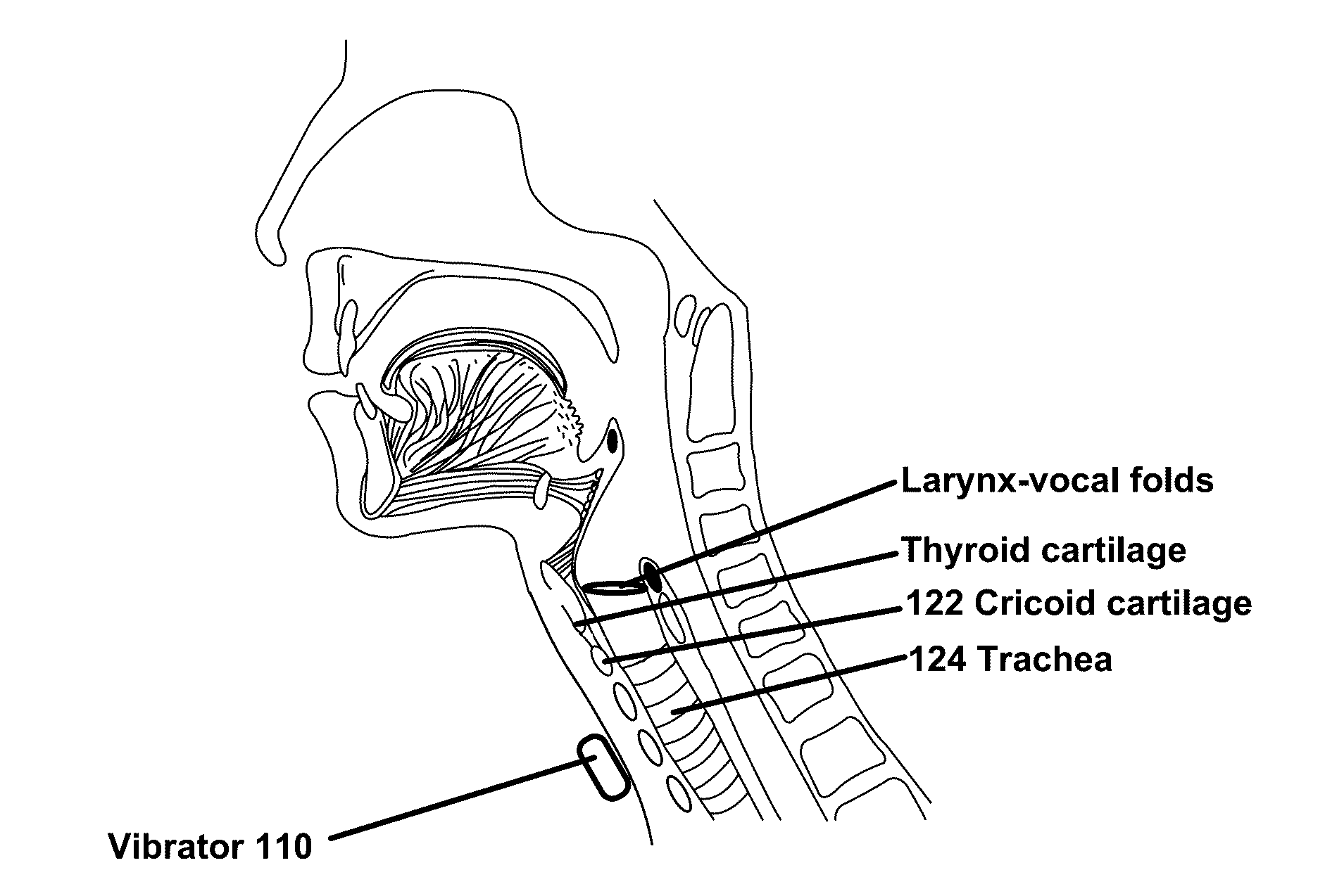 Vibratory Cough Suppression