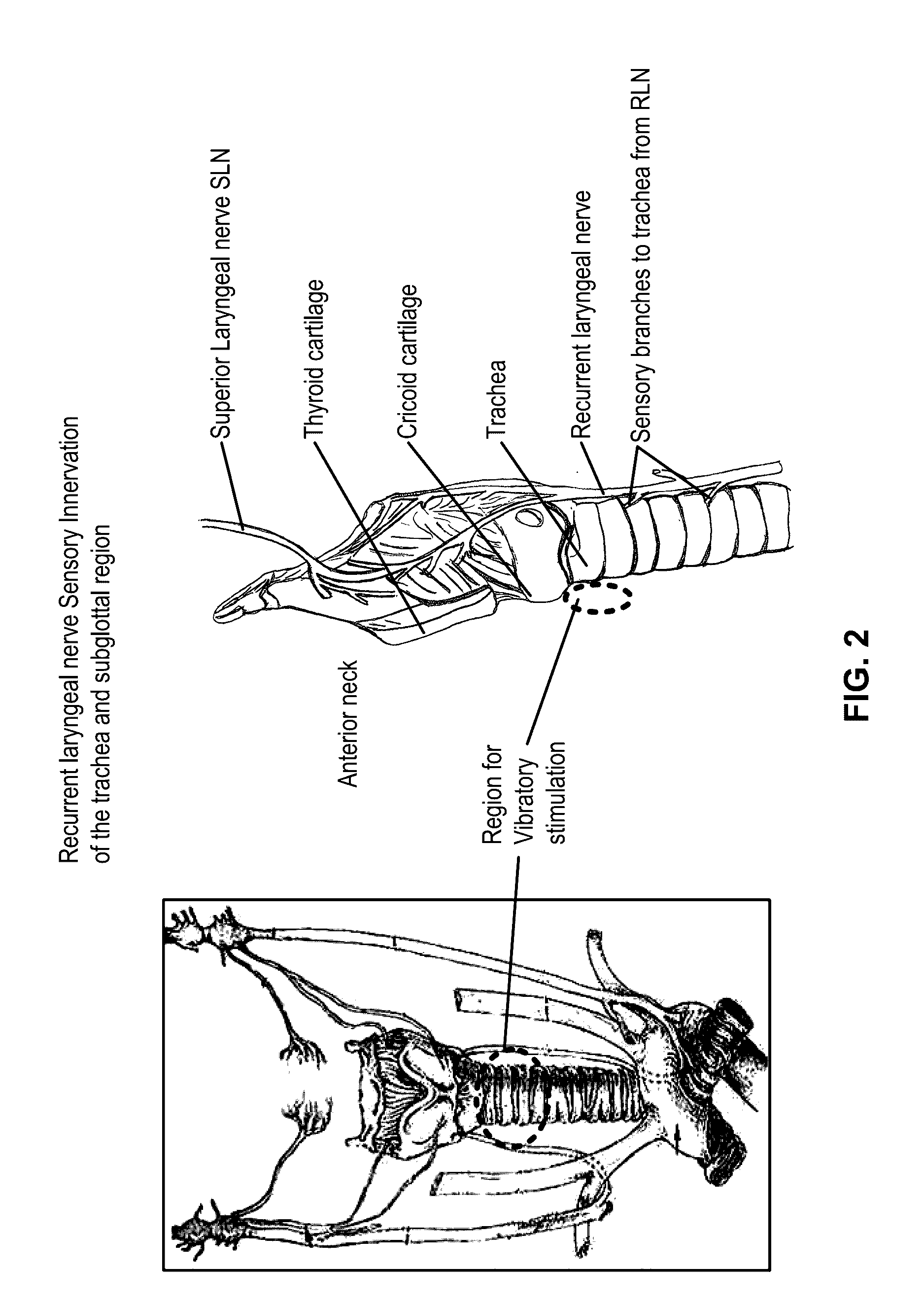 Vibratory Cough Suppression