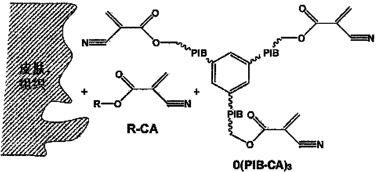Poly(octyl cyanoacrylate)-olyisobutylene polymer conetwork, method for the production thereof and uses thereof