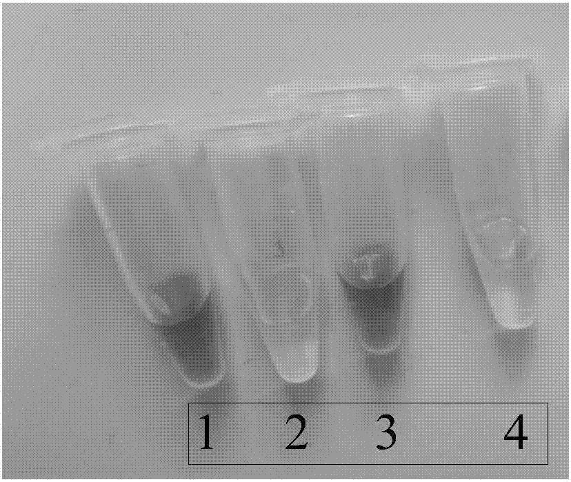 Kit and detection method for detecting mycobacterium tuberculosis infection