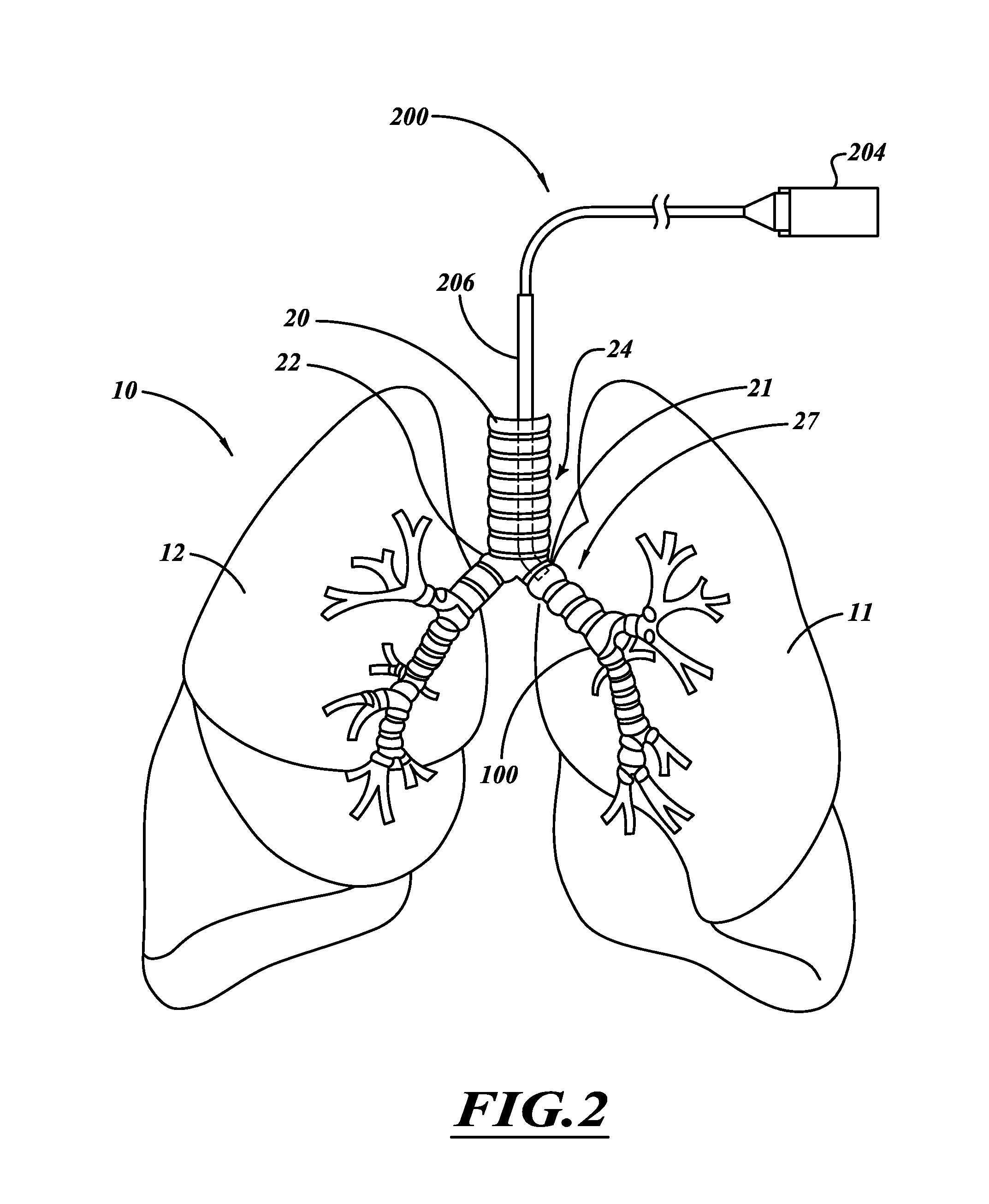 Apparatus for injuring nerve tissue