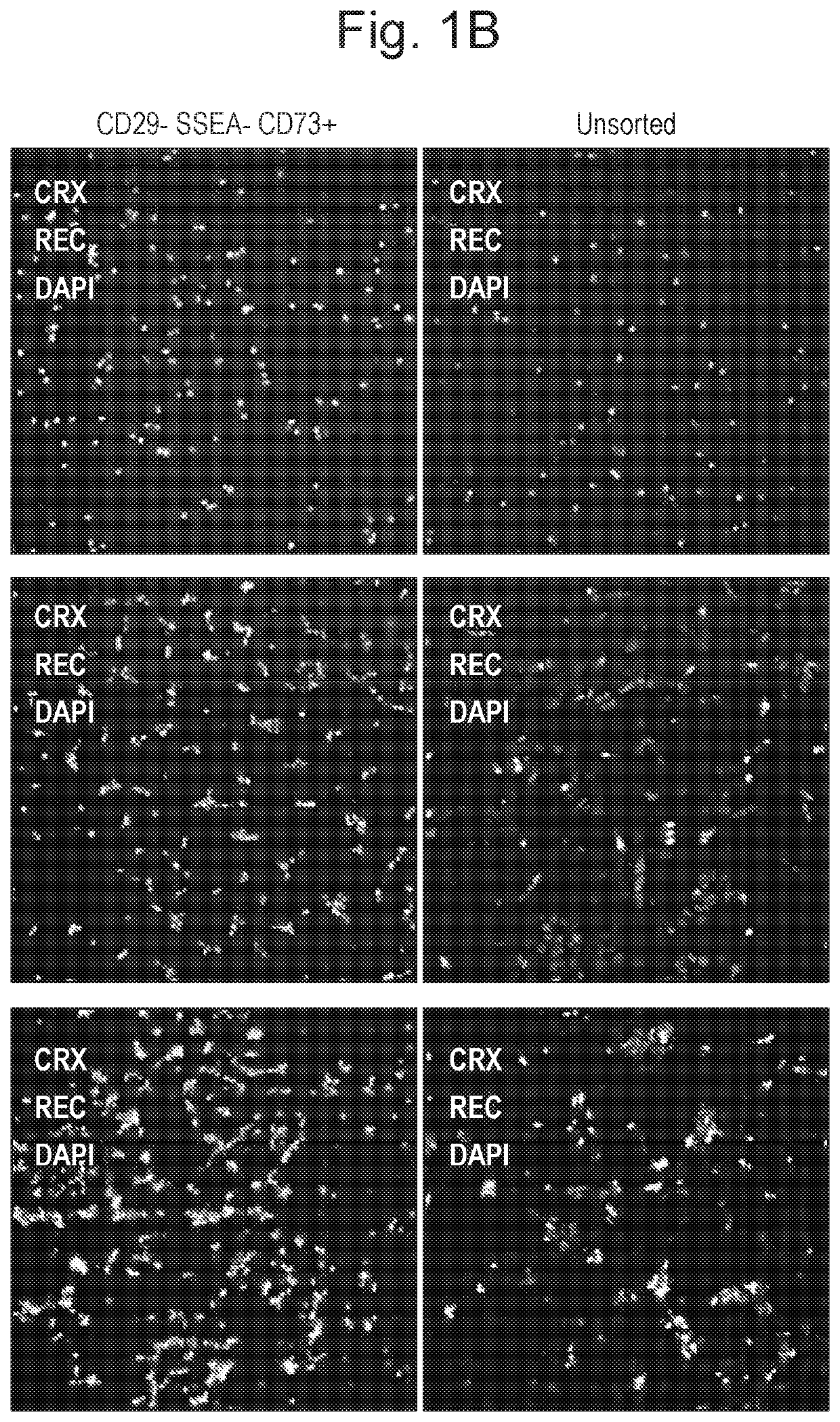 Biomarkers for photoreceptor cells