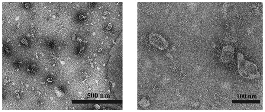 Mesenchymal stem cell exosome agent based on DNA tetrahedron, preparation method and application of mesenchymal stem cell exosome agent