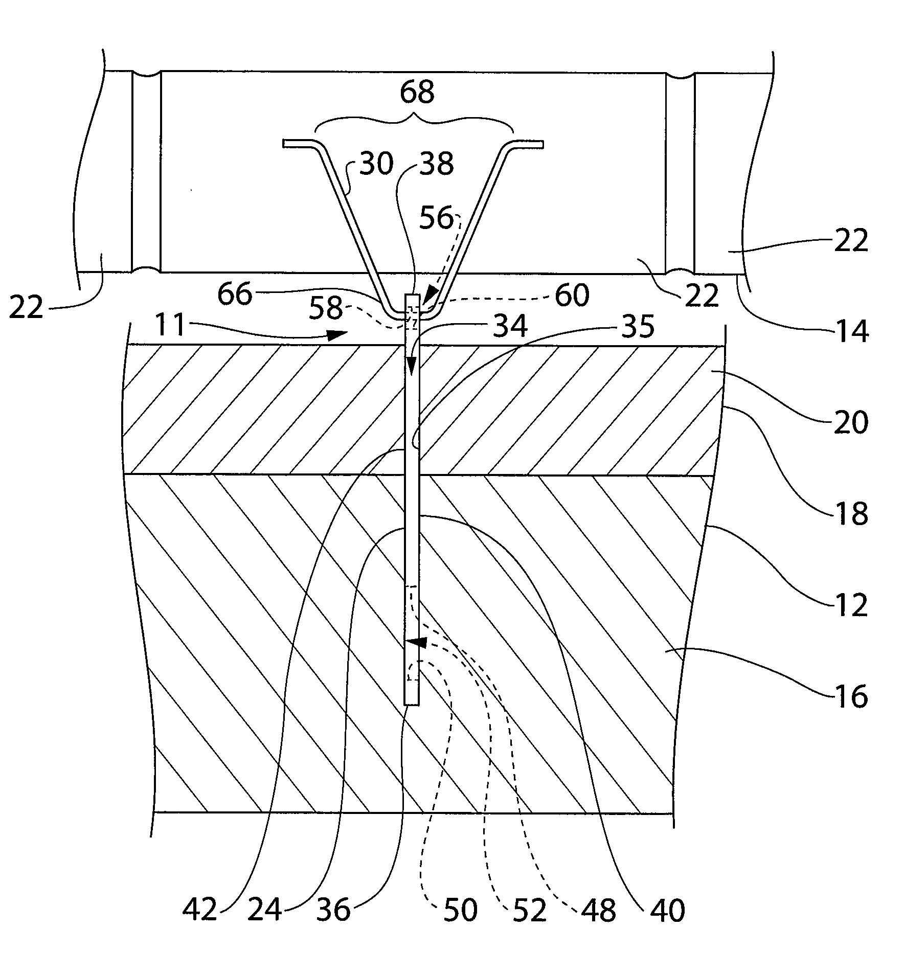 Tie system and method for connecting a cementitious backup wall made in a penetrable form and a veneer wall