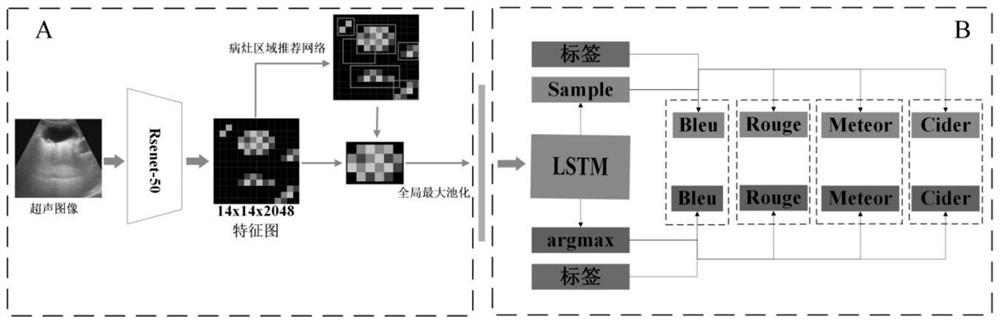 Ultrasonic image diagnosis report generation method based on target detection and strategy gradient