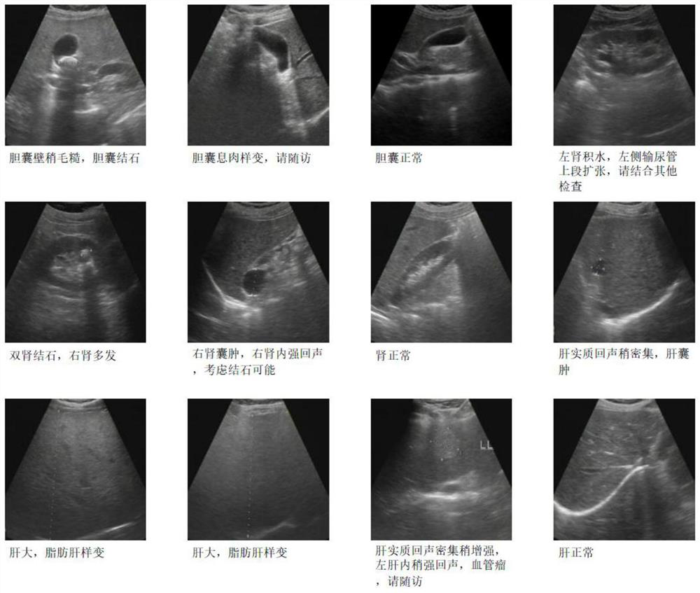 Ultrasonic image diagnosis report generation method based on target detection and strategy gradient