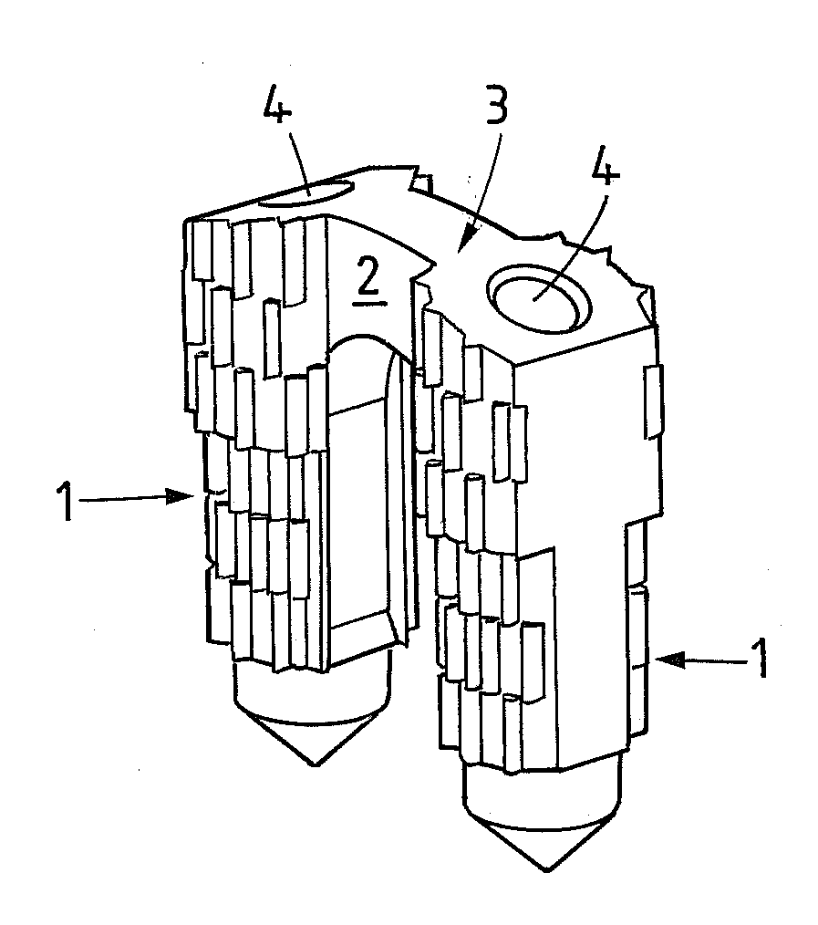 Method and implant for stabilizing two bone portions separated by a cut or fracture