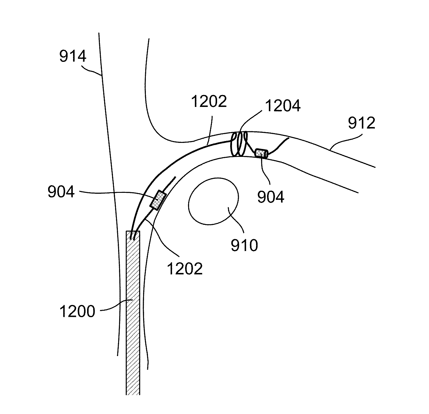 Methods and systems for treating nerve structures