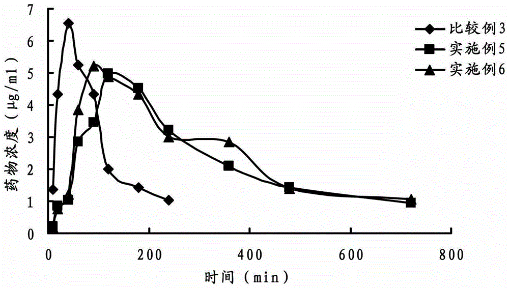 Ophthalmic gel containing dorzolamide and timolol and preparation method thereof