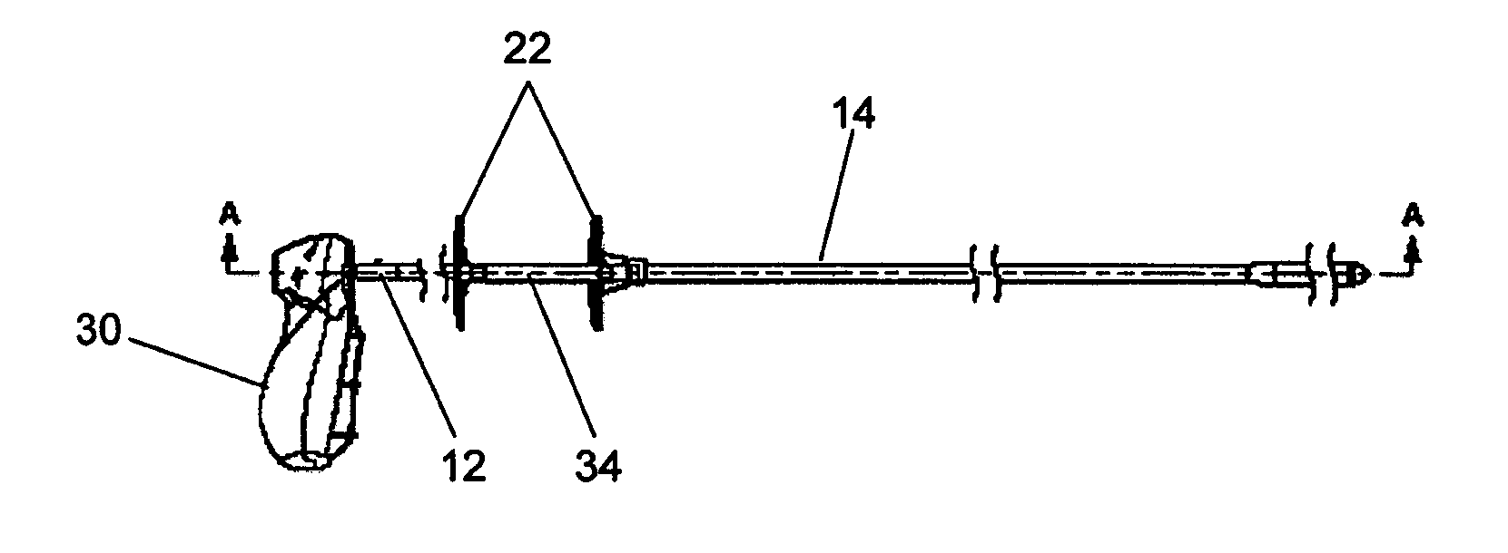 Delivery device with anchoring features and associated method
