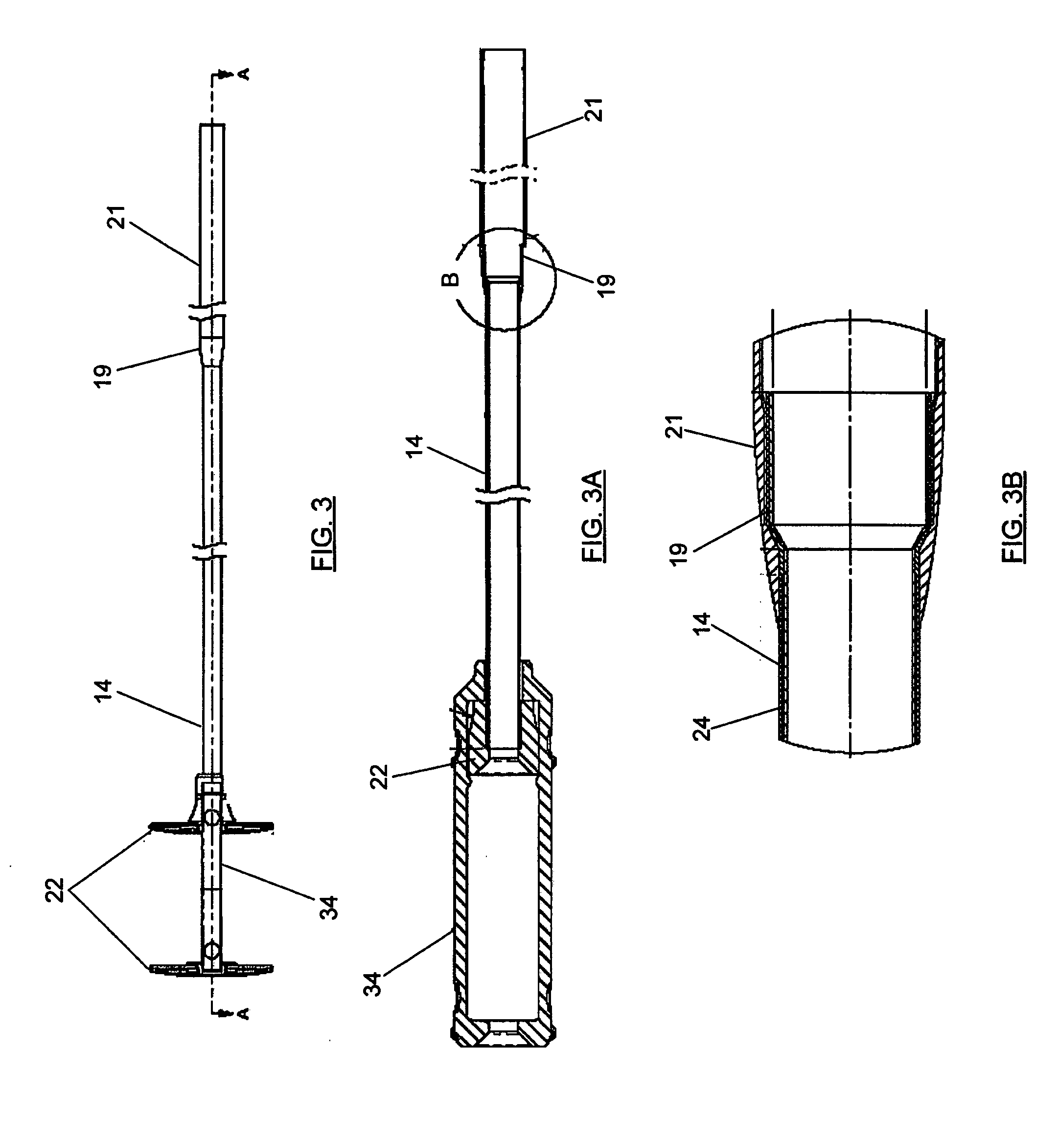 Delivery device with anchoring features and associated method