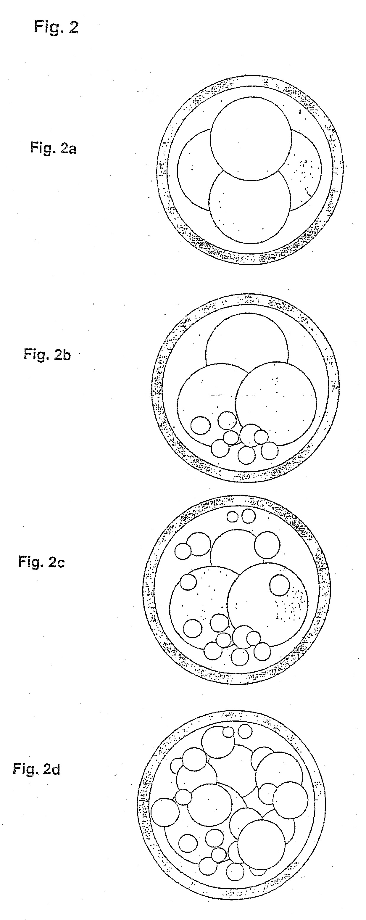 In vitro fertilisation