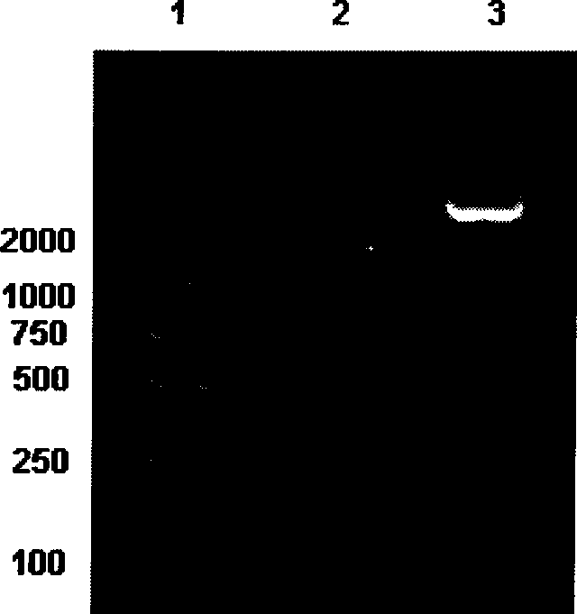 Recombinant adenovirus of Survivin promoter regulated human NIS gene, construction method and use