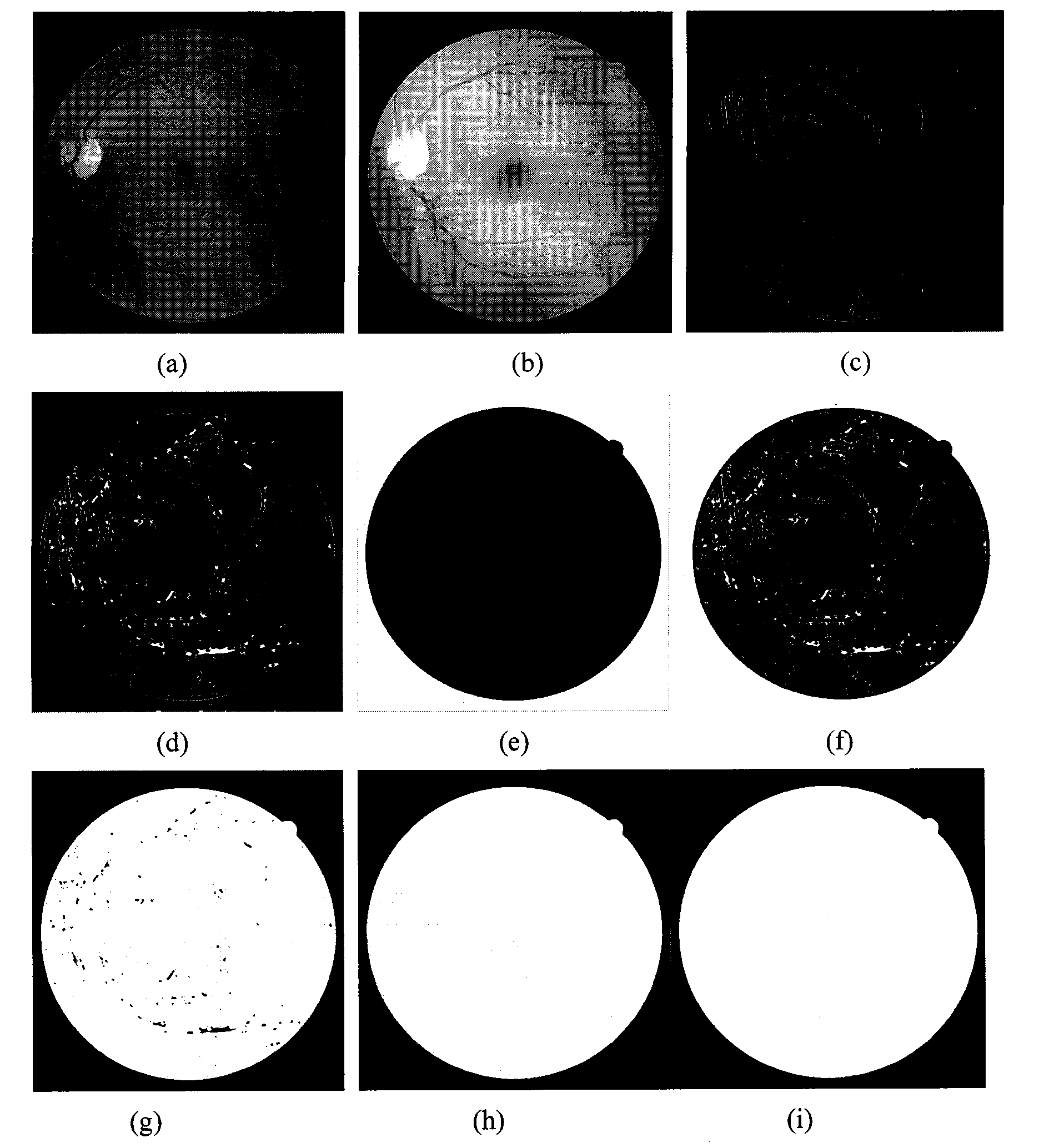 Retinal image segmentation method based on NSCT feature extraction and supervised classification