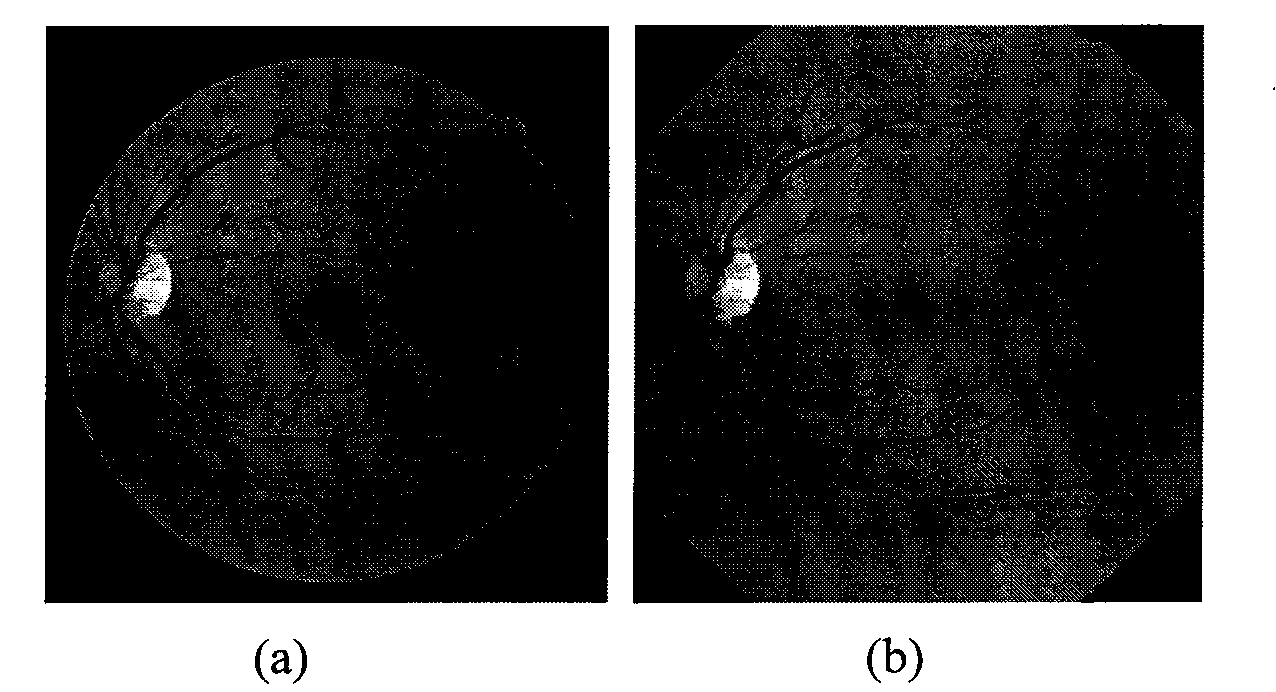 Retinal image segmentation method based on NSCT feature extraction and supervised classification